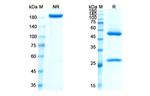 Losatuxizumab Chimeric Antibody in SDS-PAGE (SDS-PAGE)