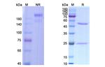 Alpha-hemolysin (Suvratoxumab Biosimilar) Antibody in SDS-PAGE (SDS-PAGE)