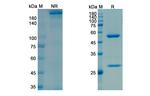 NGF (Frunevetmab Biosimilar) Recombinant Feline Monoclonal Antibody