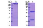 Lesofavumab Recombinant Human Monoclonal Antibody