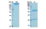 Gedivumab Recombinant Human Monoclonal Antibody