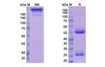 Azintuxizumab Chimeric Recombinant Human Monoclonal Antibody