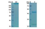 Gilvetmab Antibody in SDS-PAGE (SDS-PAGE)