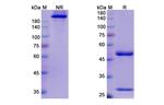 Cosfroviximab Chimeric Recombinant Human Monoclonal Antibody