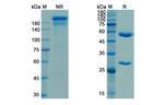 Porgaviximab Chimeric Recombinant Human Monoclonal Antibody