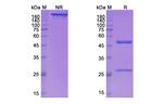 Larcaviximab Chimeric Recombinant Human Monoclonal Antibody