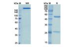 EGFR (Tomuzotuximab Biosimilar) Antibody in SDS-PAGE (SDS-PAGE)