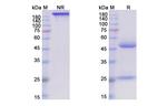 Timigutuzumab Humanized Antibody in SDS-PAGE (SDS-PAGE)