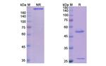 MUC1 (Gatipotuzumab Biosimilar) Recombinant Humanized mouse Monoclonal Antibody