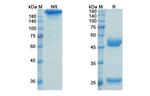 CD123 (Talacotuzumab Biosimilar) Antibody in SDS-PAGE (SDS-PAGE)