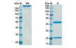 Gimsilumab Recombinant Human Monoclonal Antibody