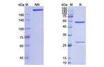 Tislelizumab Humanized Antibody in SDS-PAGE (SDS-PAGE)