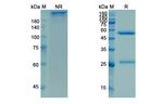 Mosunetuzumab Humanized Antibody in SDS-PAGE (SDS-PAGE)
