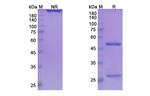 Ladiratuzumab Humanized Recombinant Human Monoclonal Antibody