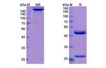 Atidortoxumab Recombinant Human Monoclonal Antibody