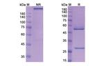 Tiragolumab Humanized Antibody in SDS-PAGE (SDS-PAGE)