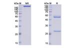 Mirikizumab Humanized Antibody in SDS-PAGE (SDS-PAGE)