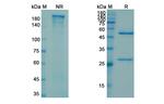 Cofetuzumab Humanized Antibody in SDS-PAGE (SDS-PAGE)