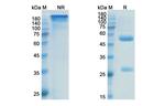alpha Synuclein (Prasinezumab Biosimilar) Antibody in SDS-PAGE (SDS-PAGE)