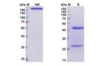 Narsoplimab Antibody in SDS-PAGE (SDS-PAGE)