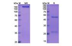 MAdCAM-1 (Ontamalimab Biosimilar) Antibody in SDS-PAGE (SDS-PAGE)