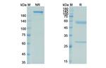 Netakimab Chimeric Antibody in SDS-PAGE (SDS-PAGE)