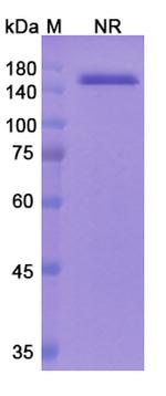 Angiopoietin 2/VEGF (Faricimab Biosimilar) Antibody in SDS-PAGE (SDS-PAGE)