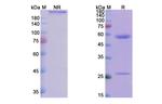 Iscalimab Humanized Antibody in SDS-PAGE (SDS-PAGE)