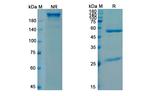 Sutimlimab Chimeric Recombinant Human Monoclonal Antibody