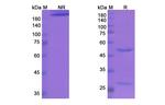 TIGIT (Etigilimab Biosimilar) Antibody in SDS-PAGE (SDS-PAGE)