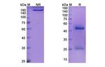 Lenvervimab Humanized Recombinant Human Monoclonal Antibody