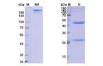 CD40 (Ravagalimab Biosimilar) Antibody in SDS-PAGE (SDS-PAGE)