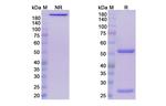 Leronlimab Humanized Recombinant Human Monoclonal Antibody