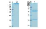 Cetrelimab Antibody in SDS-PAGE (SDS-PAGE)