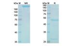 VISTA (Onvatilimab Biosimilar) Antibody in SDS-PAGE (SDS-PAGE)