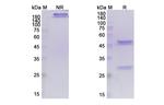 Tepoditamab Antibody in SDS-PAGE (SDS-PAGE)