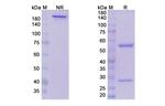 Samrotamab Chimeric Recombinant Human Monoclonal Antibody