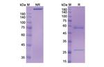 AMHR2 (Murlentamab Biosimilar) Recombinant Humanized mouse Monoclonal Antibody