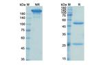 Abelacimab Antibody in SDS-PAGE (SDS-PAGE)