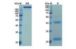 Budigalimab Chimeric Recombinant Human Monoclonal Antibody