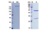 Cemiplimab Antibody in SDS-PAGE (SDS-PAGE)