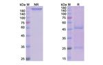 Dilpacimab Humanized Antibody in SDS-PAGE (SDS-PAGE)