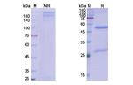 Dostarlimab Humanized Antibody in SDS-PAGE (SDS-PAGE)