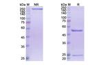 PCSK9 (Frovocimab Biosimilar) Antibody in SDS-PAGE (SDS-PAGE)