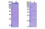 Gosuranemab Humanized Antibody in SDS-PAGE (SDS-PAGE)