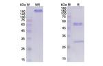 TFPI (Marstacimab Biosimilar) Antibody in SDS-PAGE (SDS-PAGE)