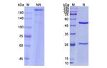 Nirsevimab Humanized Antibody in SDS-PAGE (SDS-PAGE)