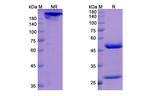 Orilanolimab Chimeric Recombinant Human Monoclonal Antibody