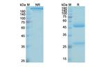 B7-H3 (CD276) (Omburtamab Biosimilar) Antibody in SDS-PAGE (SDS-PAGE)