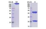 Rolinsatamab Chimeric Recombinant Human Monoclonal Antibody
